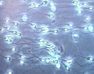 Microscope Sperm