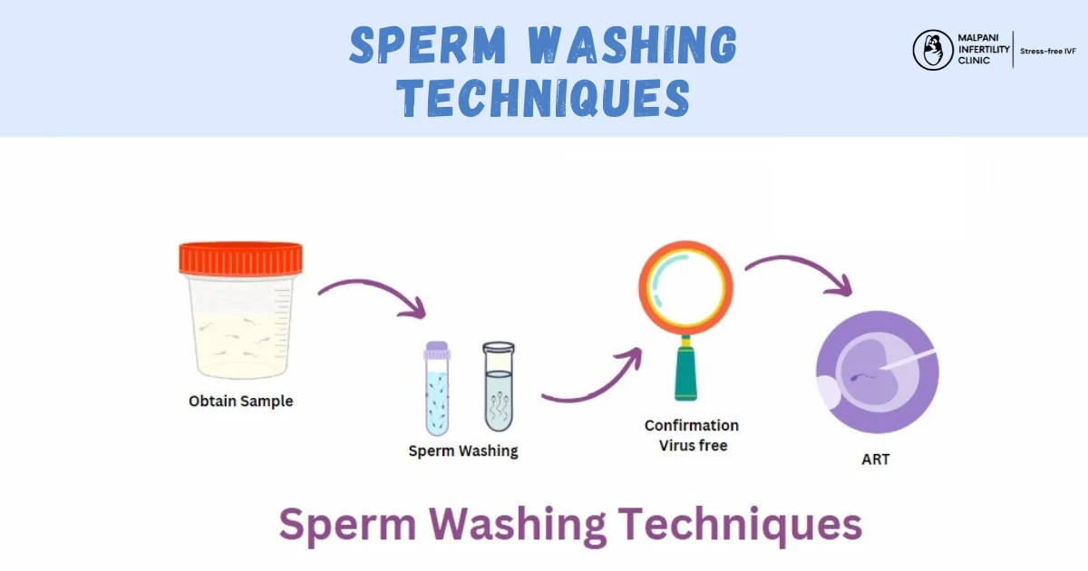 Infographic explaining sperm washing techniques in fertility treatment. The process includes obtaining a semen sample, washing sperm, confirming virus-free sperm under lab analysis, and using it for assisted reproductive technologies (ART) like IUI or IVF.