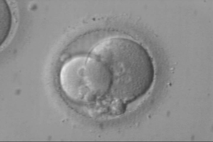 abnormal-embryo