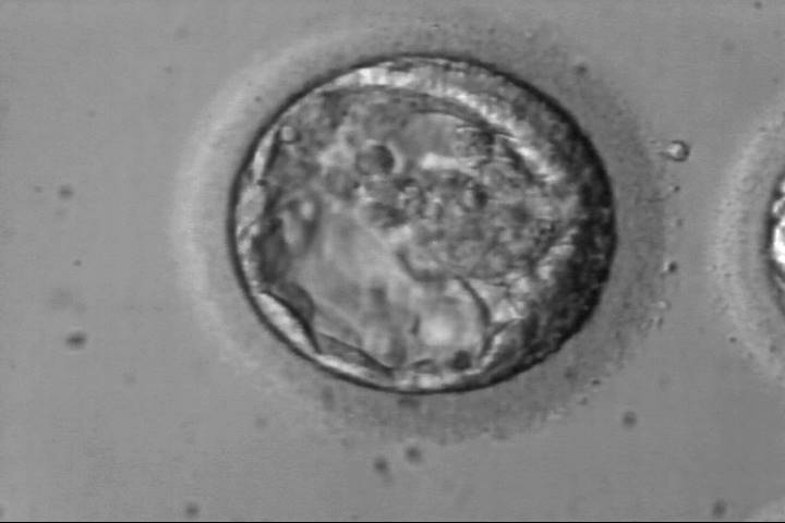 blastocyst1ba