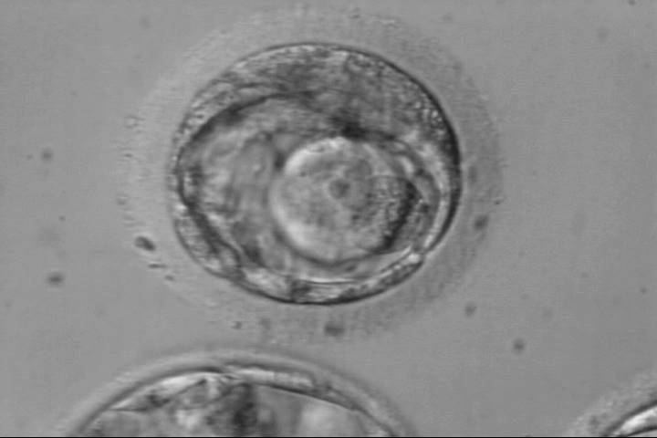 blastocyst1cc