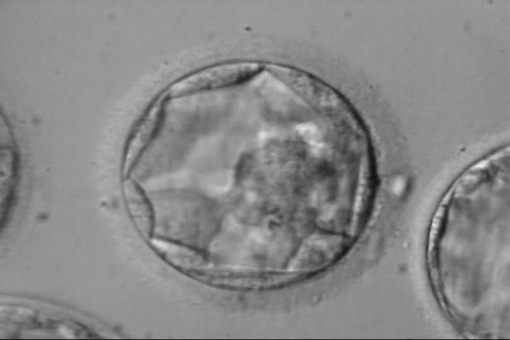 blastocyst2aa