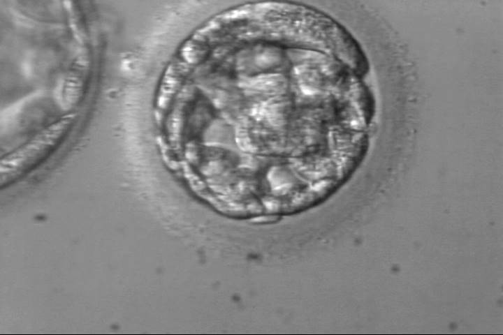 blastocyst2ab