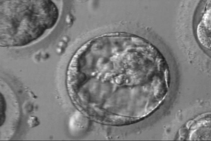 blastocyst2ac