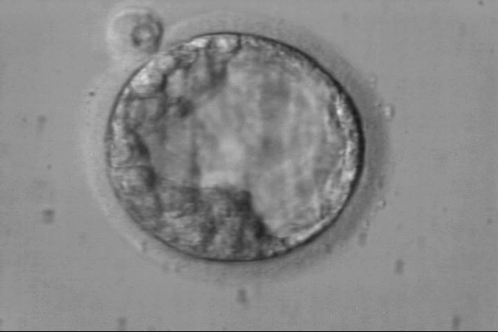 blastocyst2ba