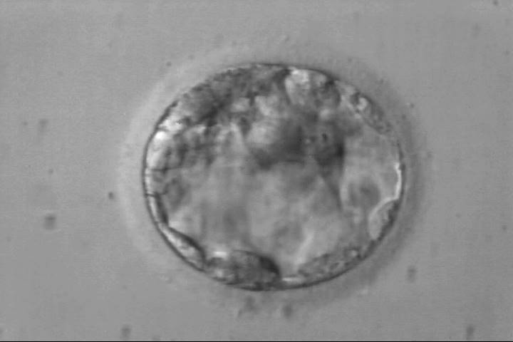 blastocyst2bb