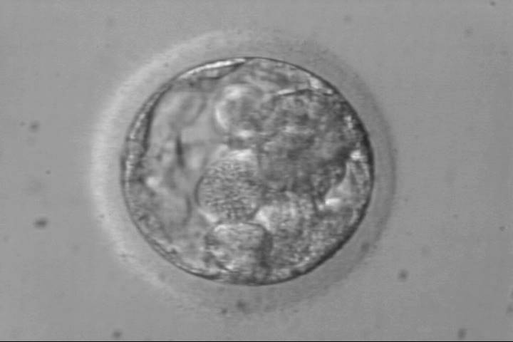 blastocyst2bc
