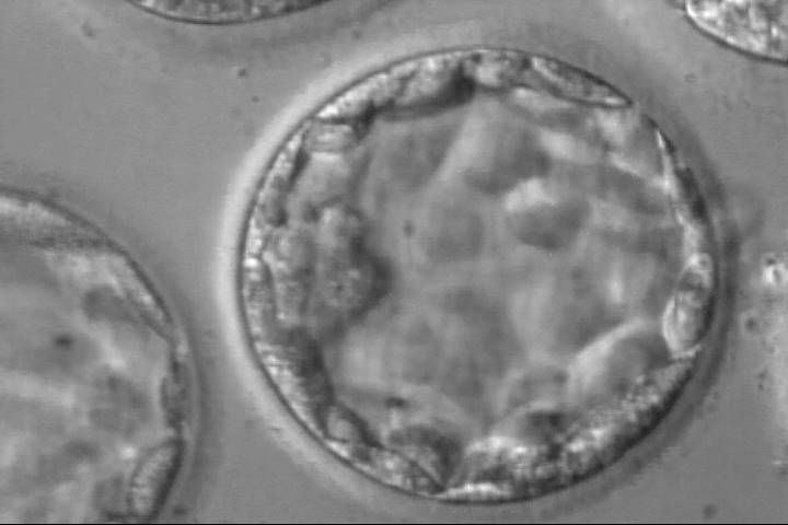 blastocyst3aa