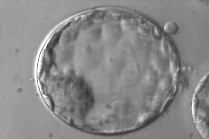 blastocyst4aa