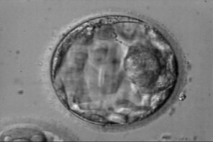 blastocyst4ab