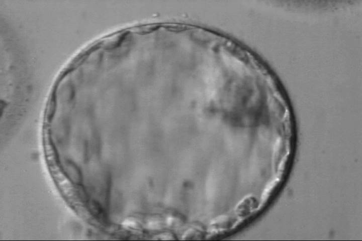blastocyst4ba