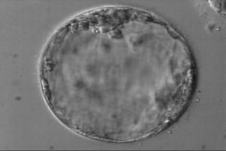 blastocyst4bb