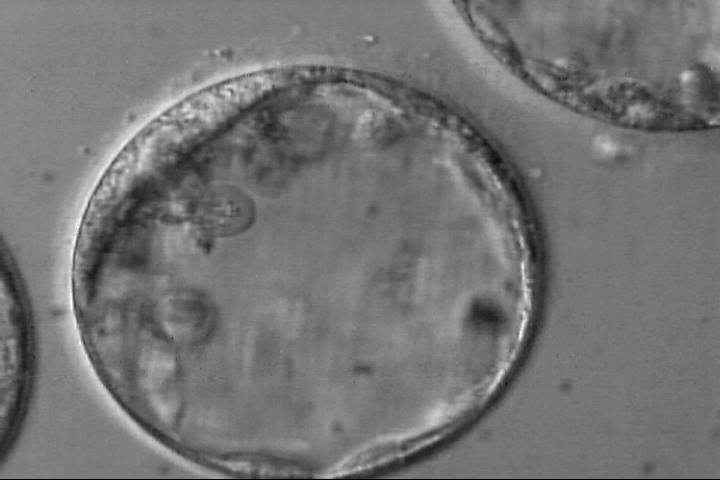blastocyst4ba
