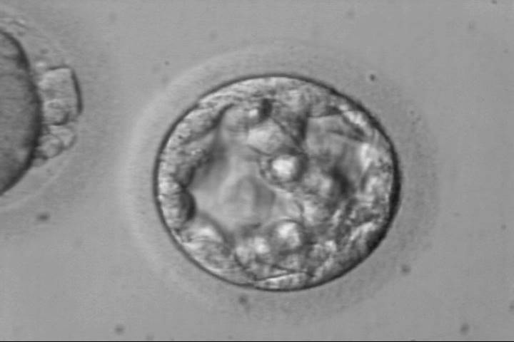 early-blastocysts2