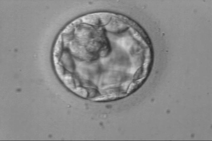 early-blastocysts3