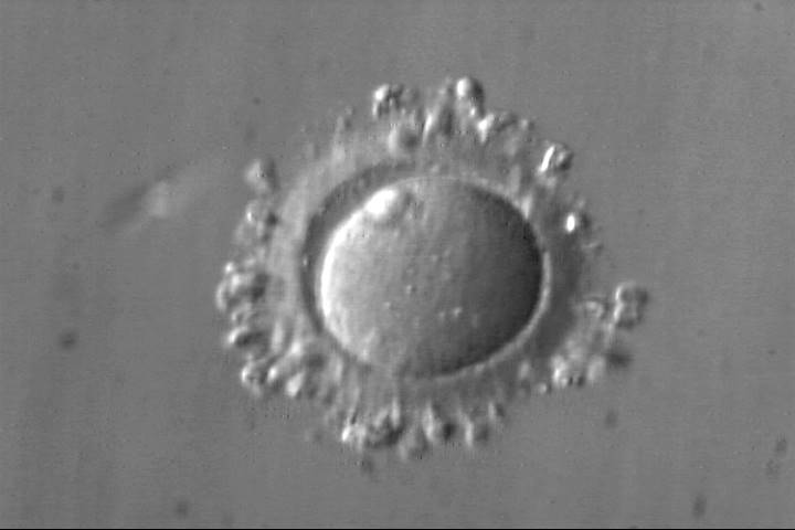 lower-magnification
