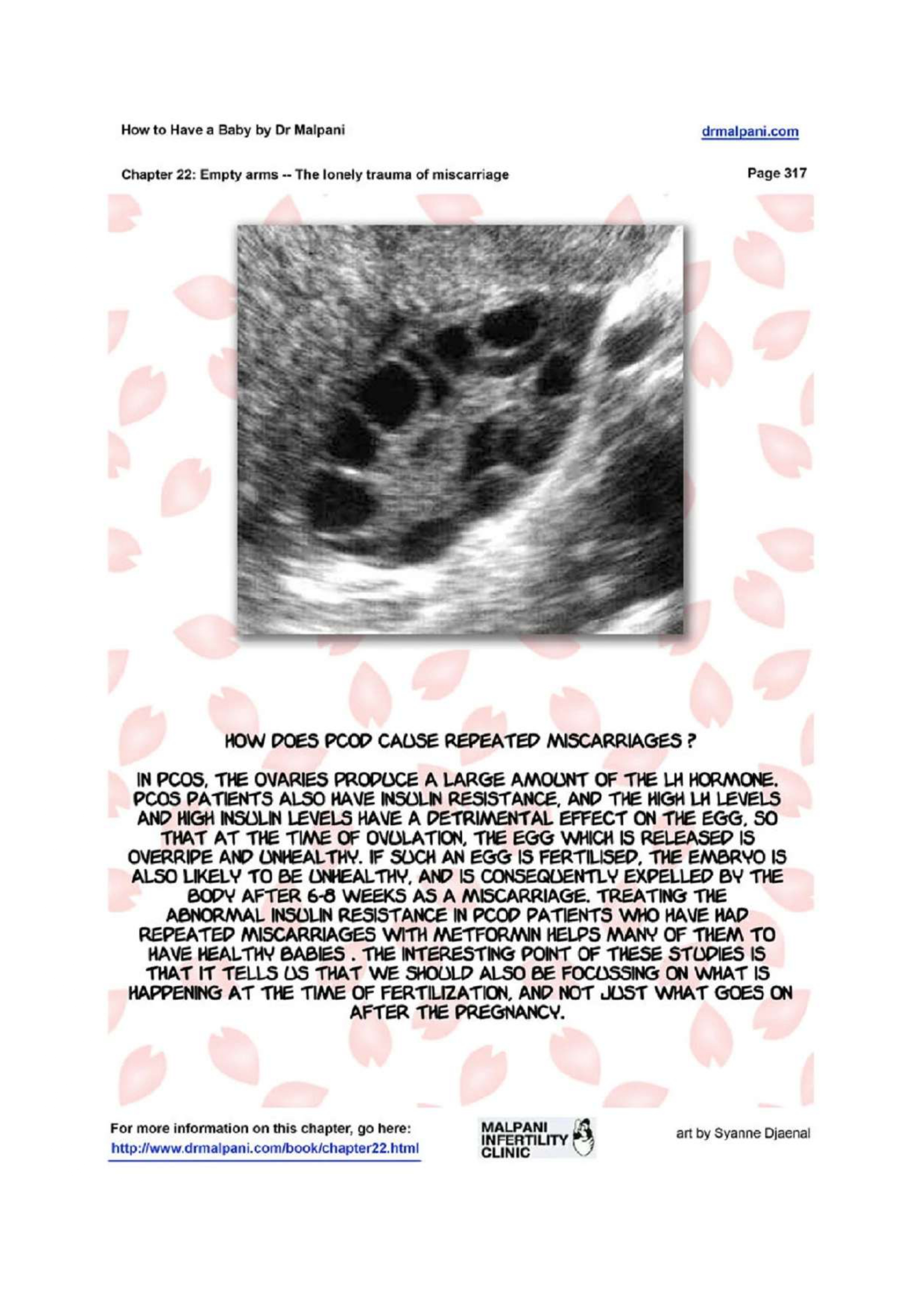 Comic on Empty Arms - The Lonely Trauma of Miscarriage