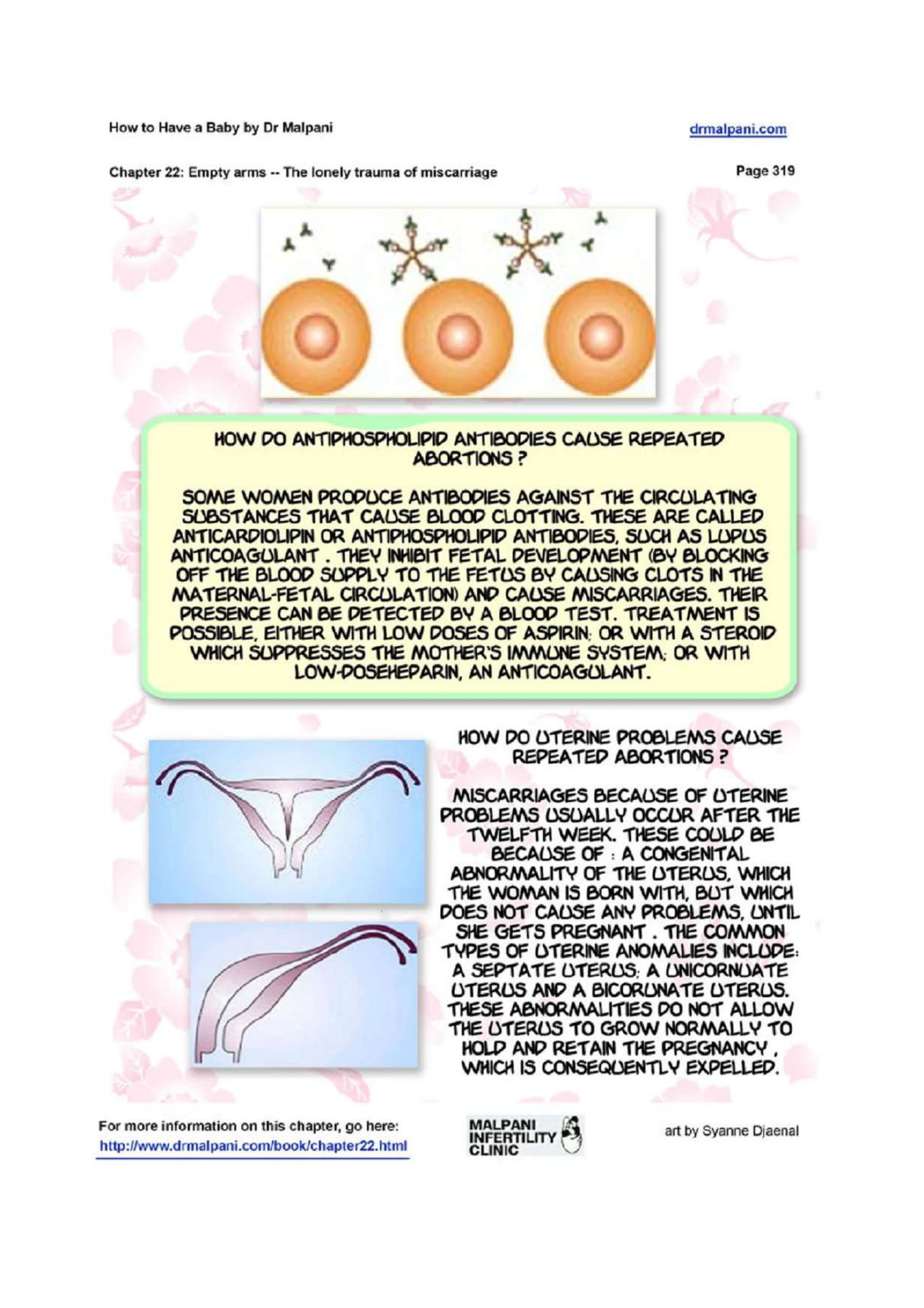 Comic on Empty Arms - The Lonely Trauma of Miscarriage