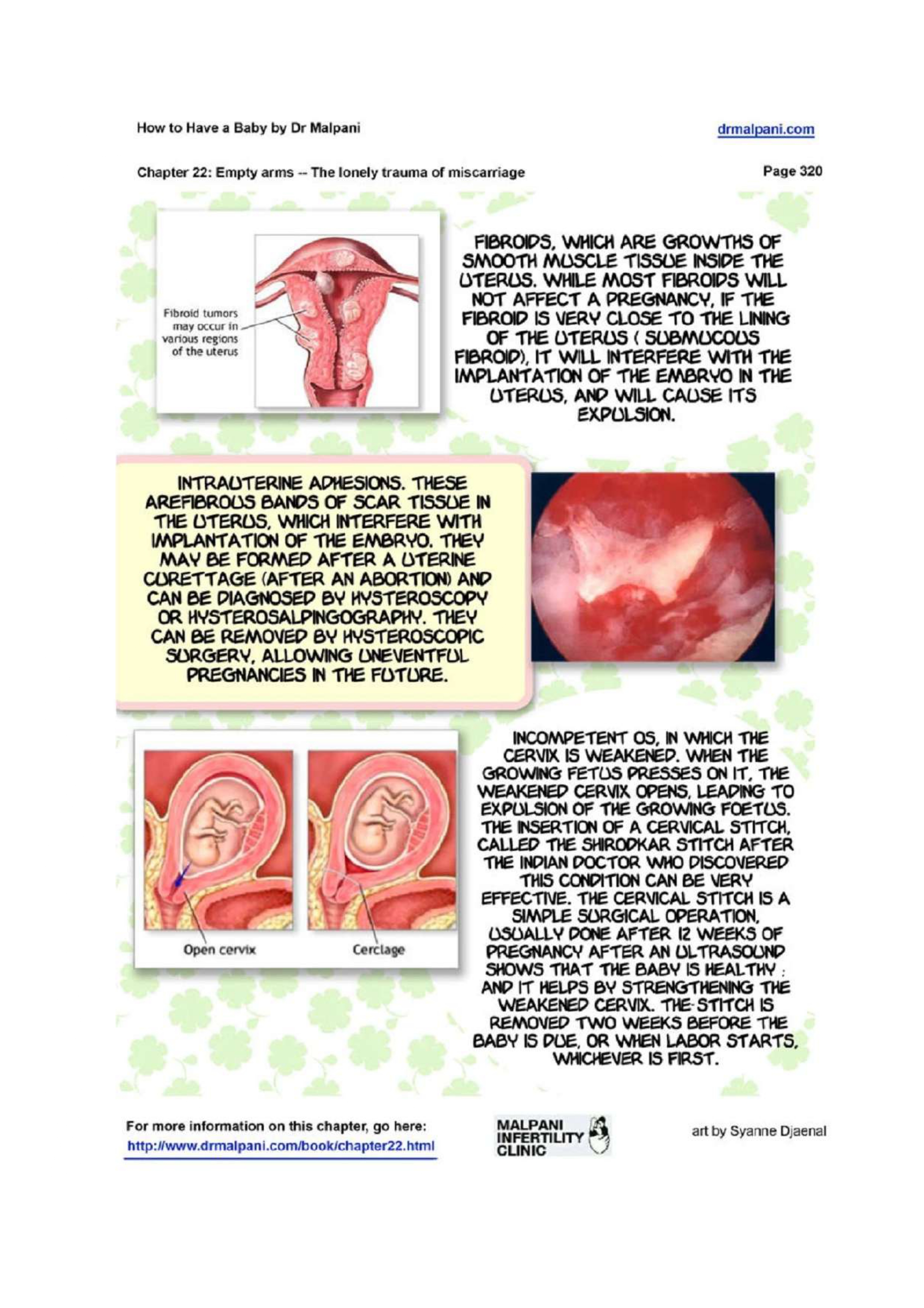 Comic on Empty Arms - The Lonely Trauma of Miscarriage
