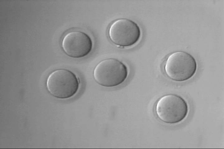 lower-magnification