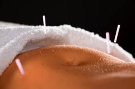 Image result for acupuncture for ivf