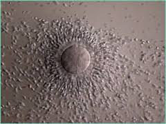 Image result for poor eggs ivf