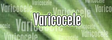 Image result for Varicocele