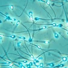 Image result for Semen Analysis