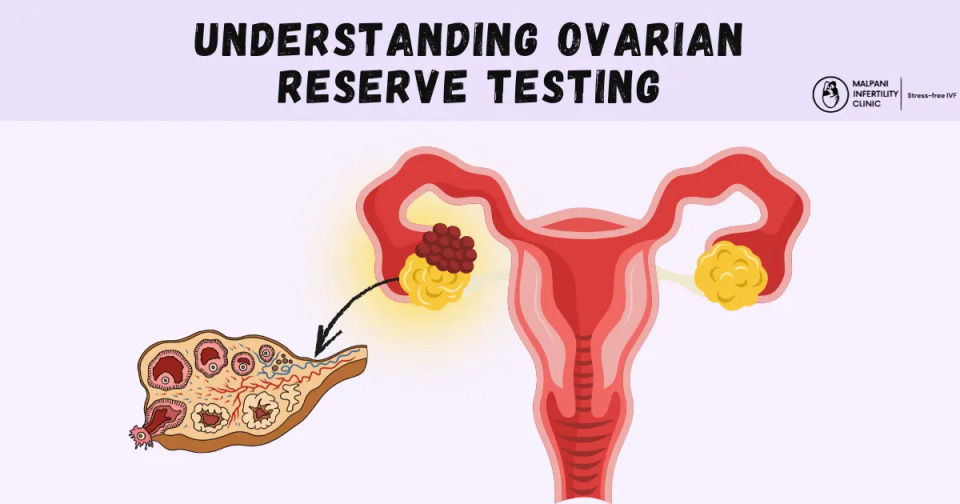 The image explains ovarian reserve testing, which measures the quantity and quality of a woman's eggs to assess fertility potential. It visually depicts developing follicles inside the ovary leading to ovulation.