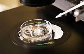 Image result for expert IVF patient