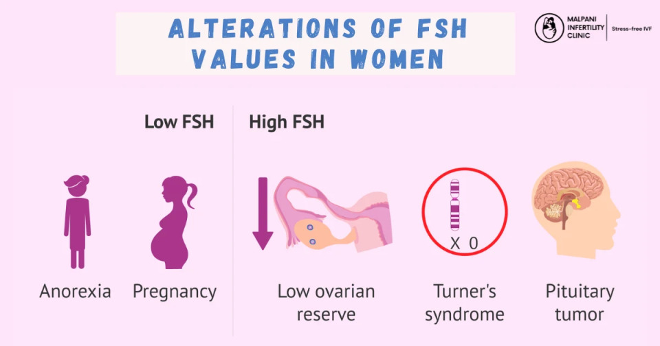 Infographic showing alterations of FSH values in women. Low FSH can occur in anorexia and pregnancy, while high FSH is linked to low ovarian reserve, Turner’s syndrome, and pituitary tumors.